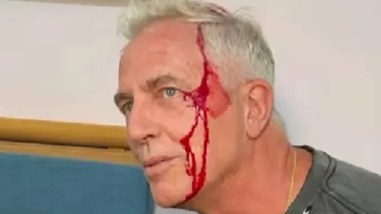 Marley se accidentó en Tailandia: «Quedé chorreando sangre»